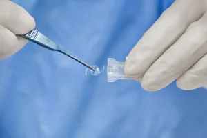 סוגי עדשות בניתוח קטרקט