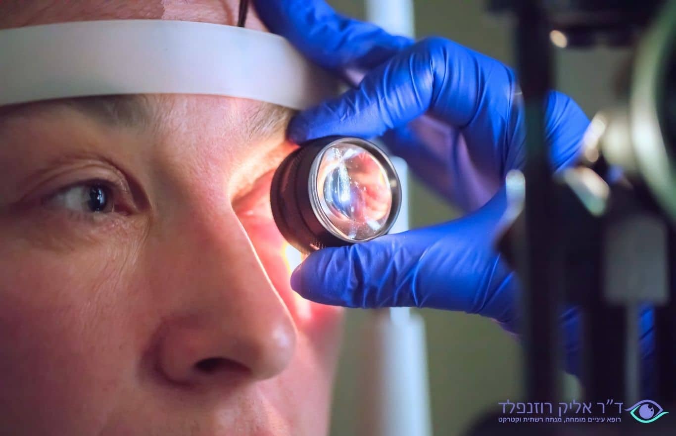 בדיקת עין כחלק מהחלמה מקרע ברשתית - דוקטור אליק רוזנפלד