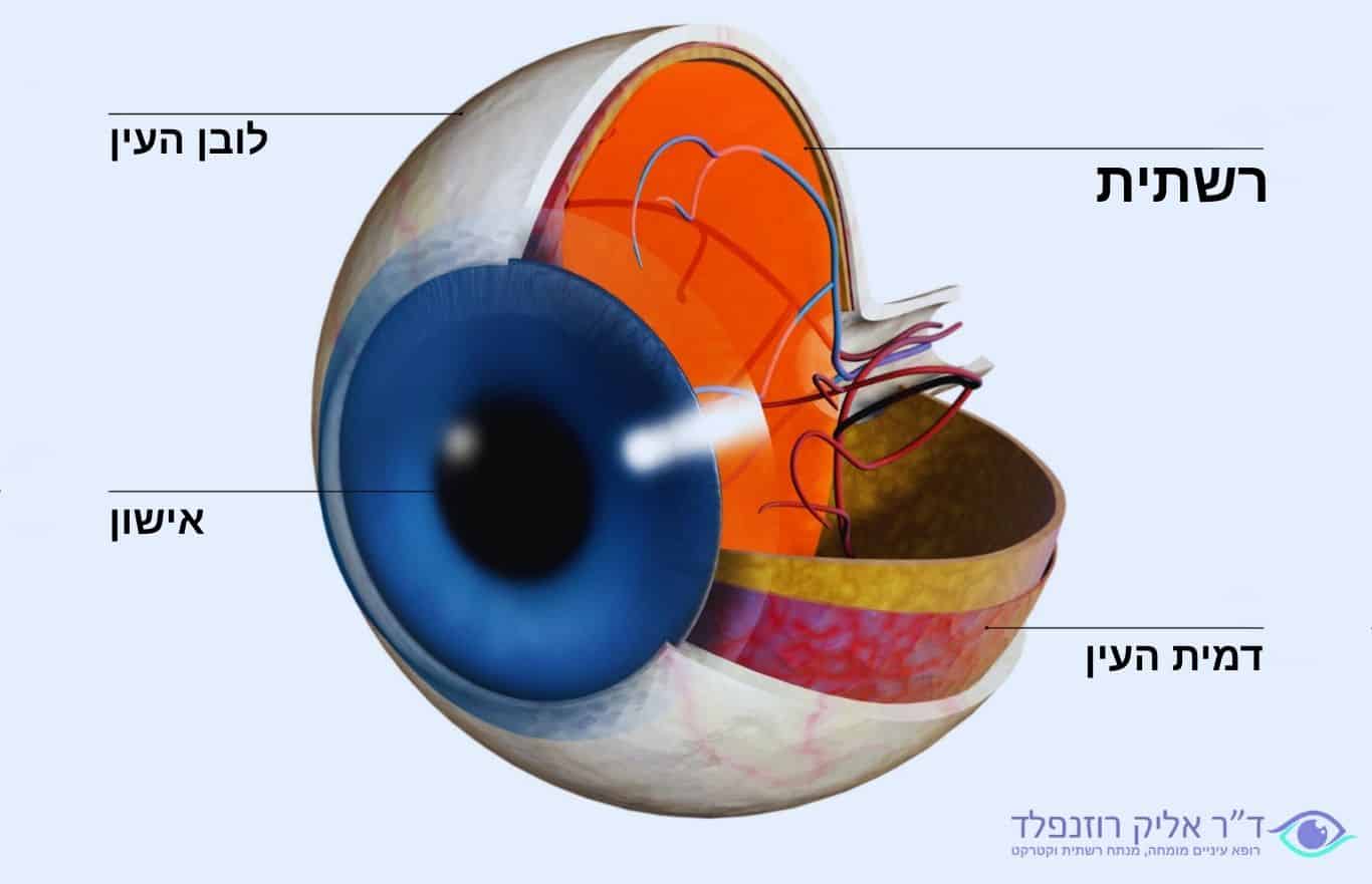 רשתית העין- דוקטור אליק רוזנפלד